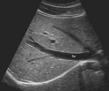 Abdomial Ultrasound Durango Colorado
