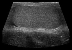 Scrotal Testicular Ultrasound Durango Colorado